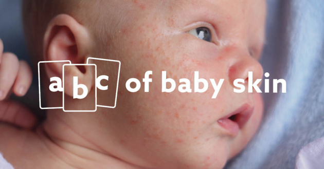 abc of baby skin