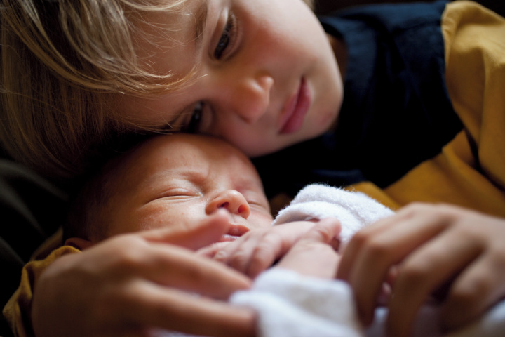 baby with jaundice