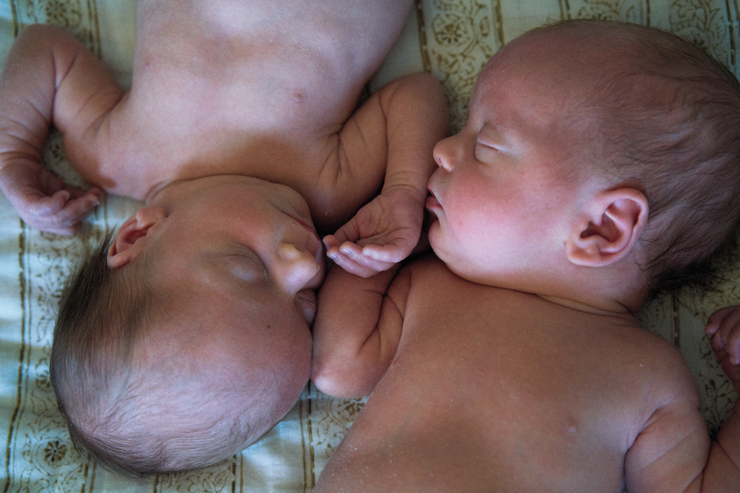 testimonio-neonatal-madre-gemelas