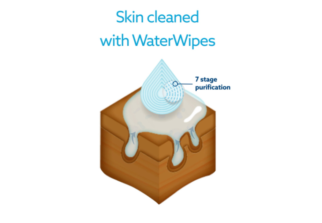 Skin cleaned with WaterWipes