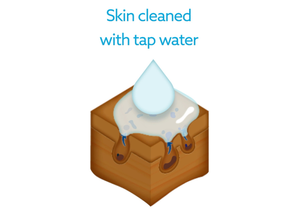 Skin cleaned with tap water