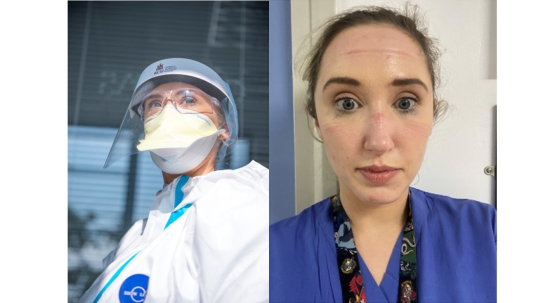 Healthcare professional wearing PPE and Healthcare professional with facial pressure injuries on face