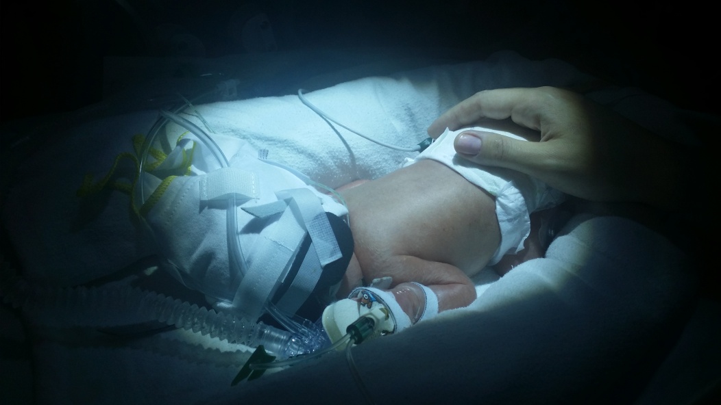 A premature baby in hospital
